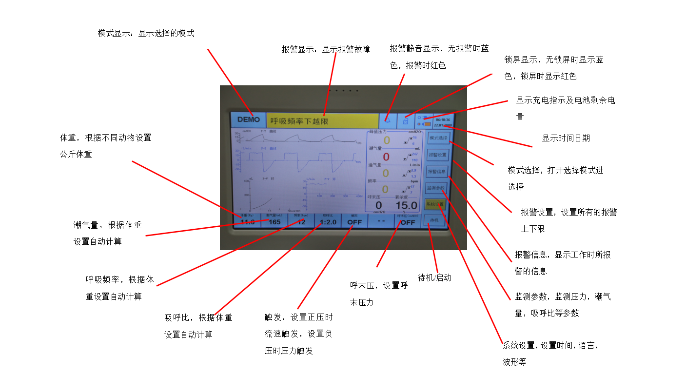 麻醉机显示屏.jpg